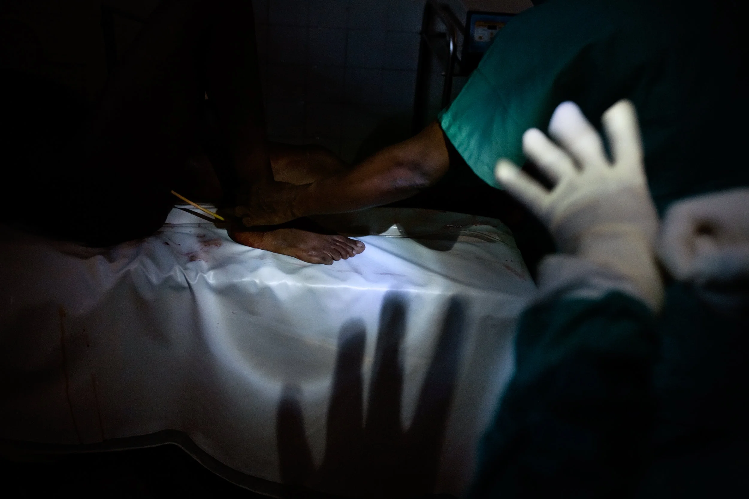 A surgical team performs a c-section during a power cut in Abobo Sud Hospital in Abidjan, Ivory Coast, April 18, 2011. A week after the end of the military standoff in Abidjan, very few hospitals were open.