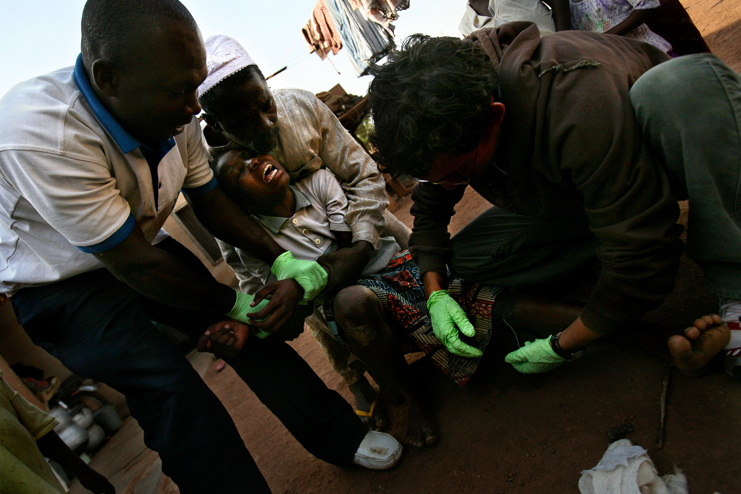  Mariam Inusa, 15, cries out in pain as health workers pull on the Guinea worm in her leg, attempting to remove it, at her home in Savelugu, Northern Region, Ghana on Jan. 26, 2008. The worm in Mariam's leg was finally pulled out after several days o