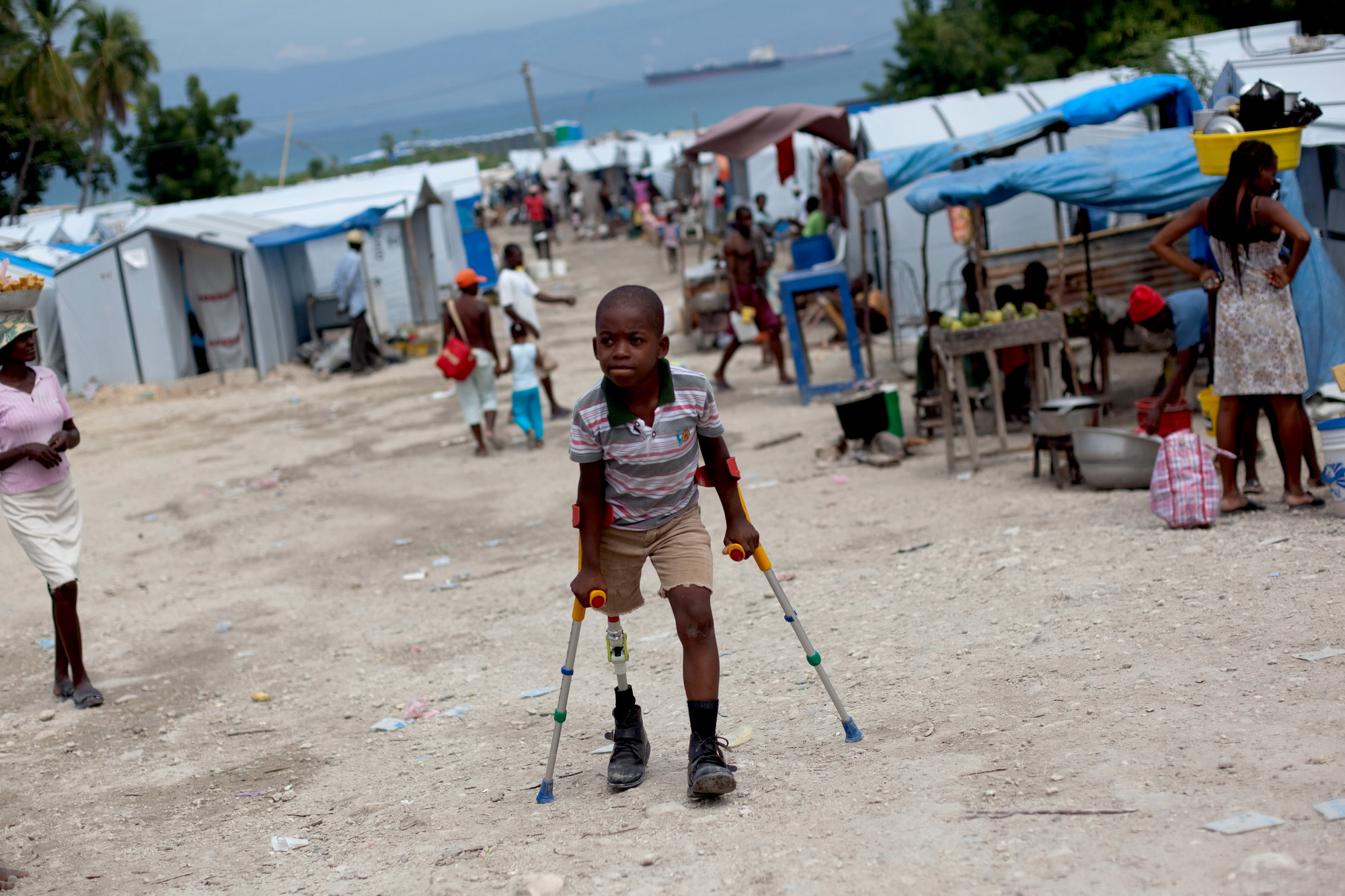 A boy walks with a prosthetic leg and crutches