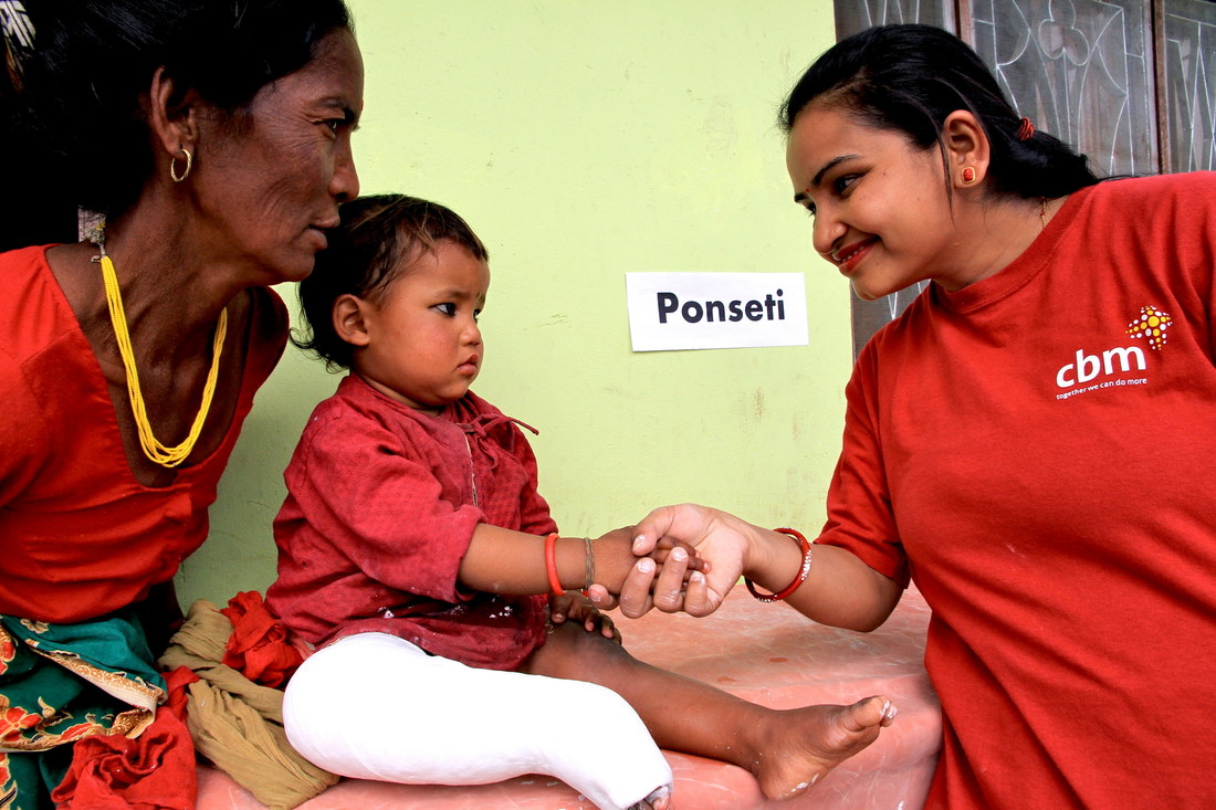 Binita shakes hands with her 2-year-old patient Archana Lama to make her smile, after applying a cast on her right leg, at a hospital in Nepal.