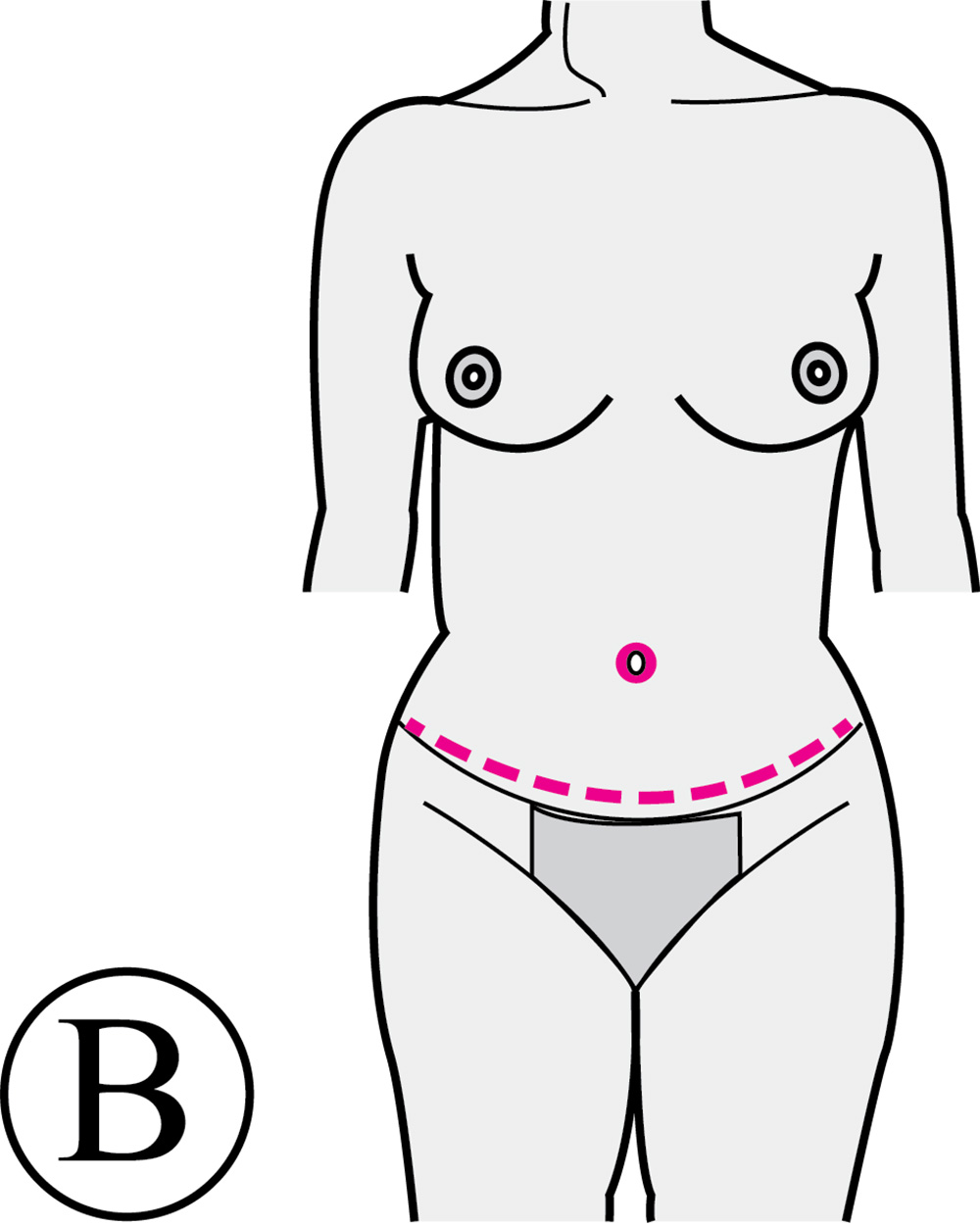 Abdominoplastie Après