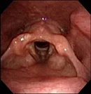 larynx.jpg