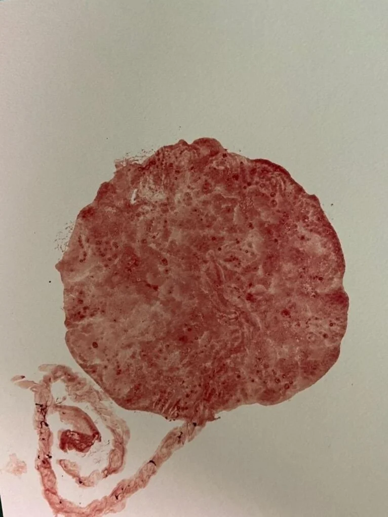 Placenta%2BPrint.jpg
