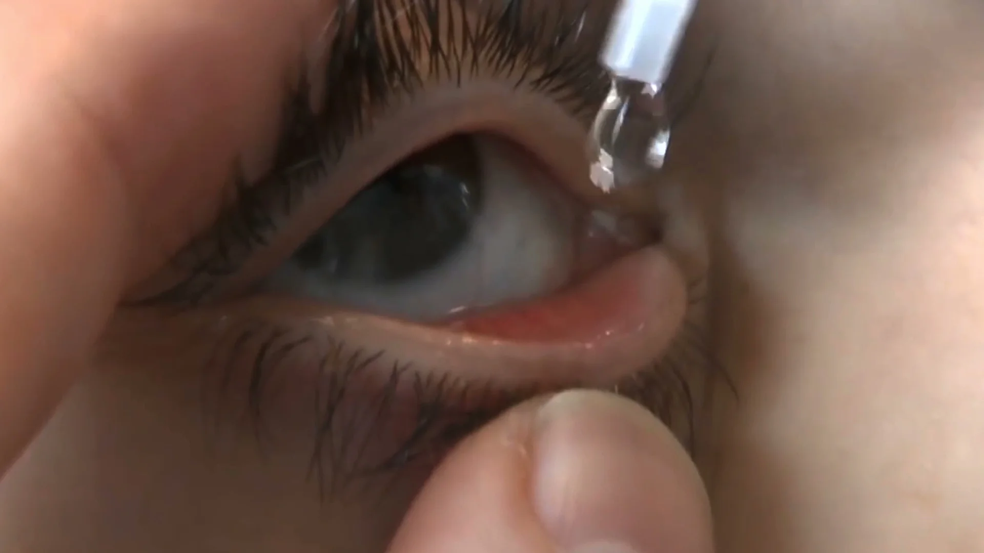 EYEDROP-stick4-2.jpeg