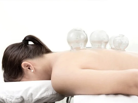 cupping.jpg