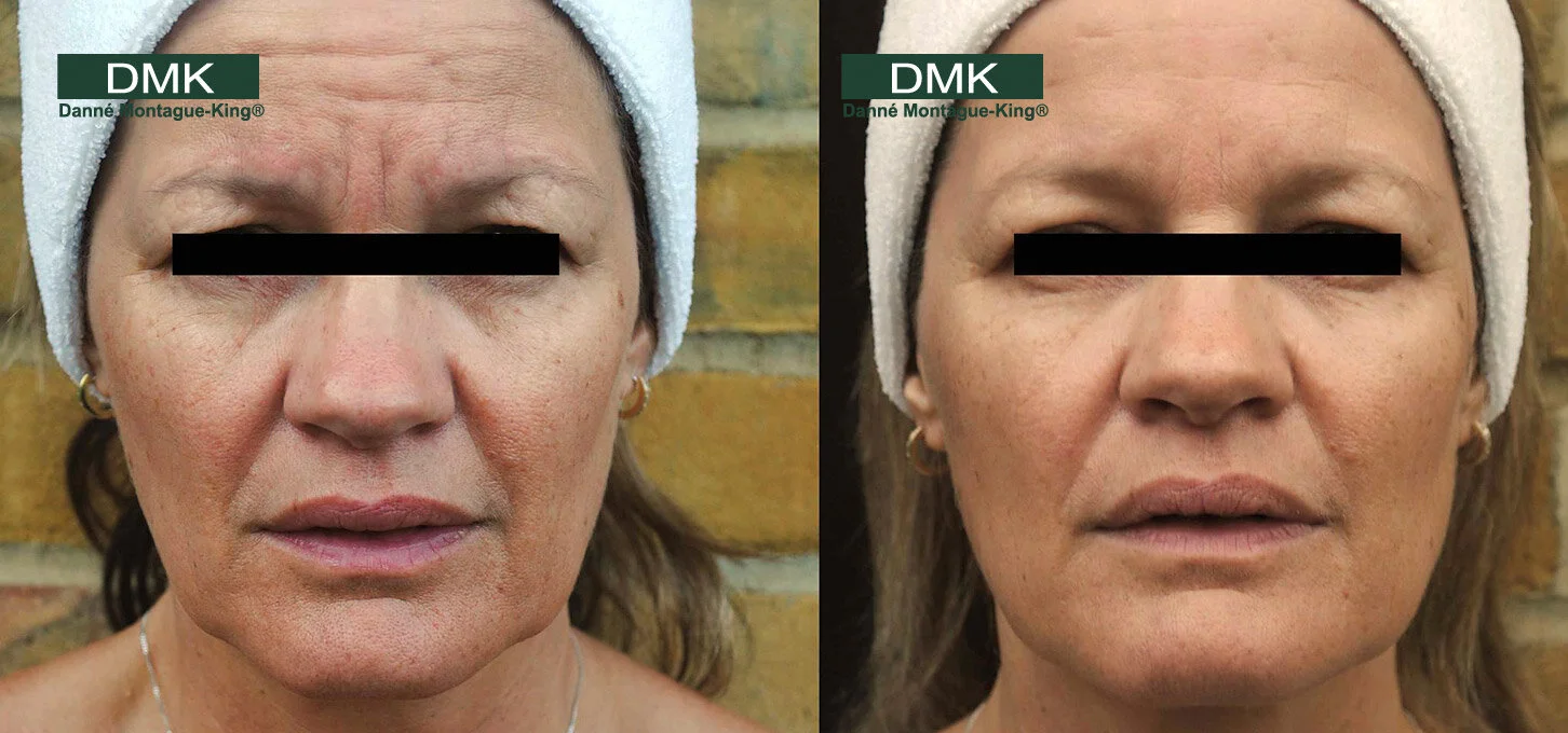 dmk facial near me