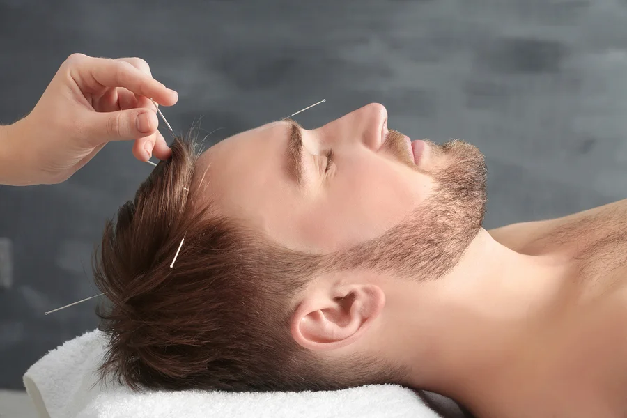 bigstock-Young-man-getting-acupuncture--181931818-FLIP.jpg