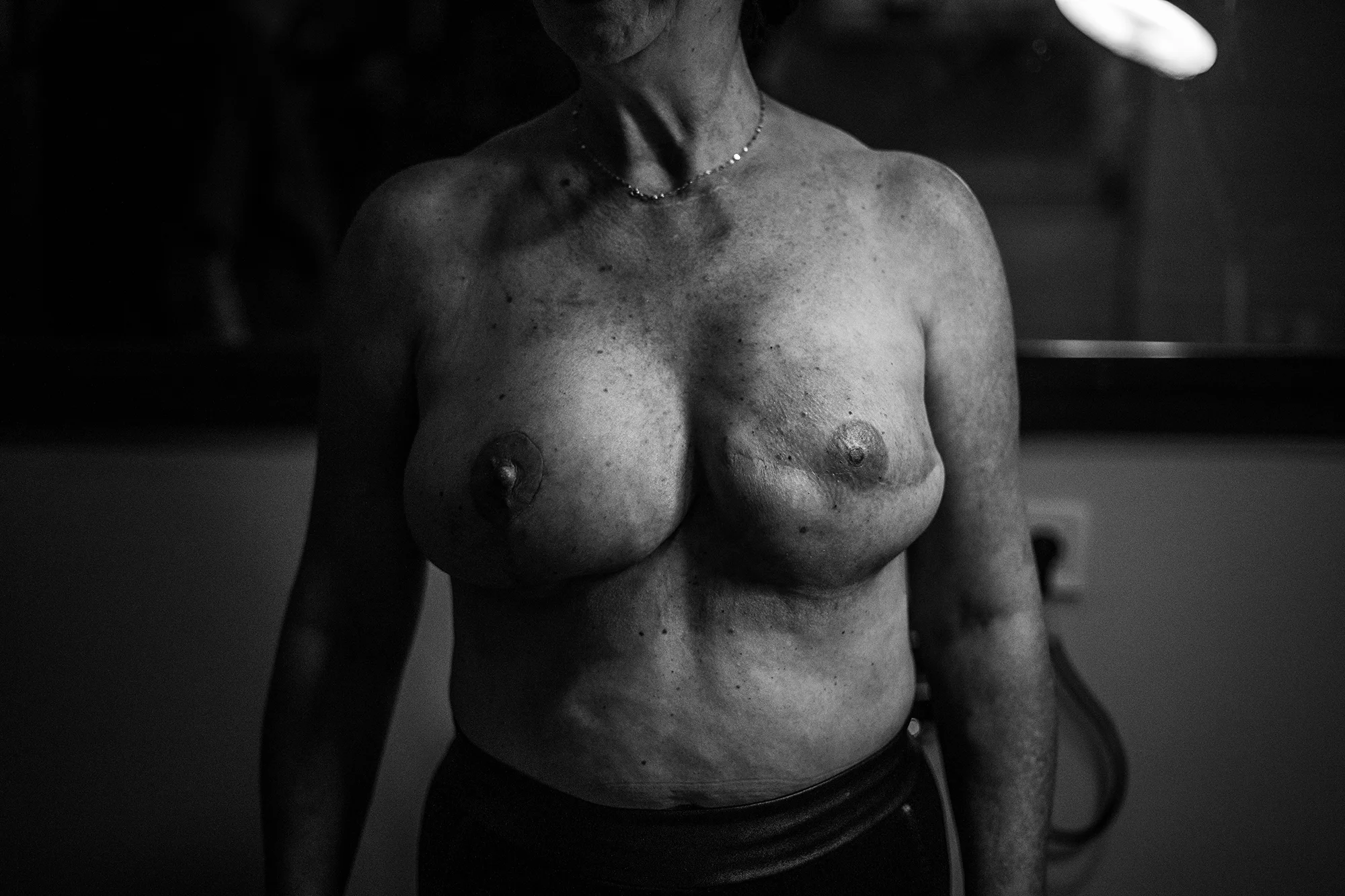 Patricia posa para un retrato después de una sesión de tatuaje para “reconstruirse” el pezón después someterse a una mastectomía. Madrid, España, diciembre 2017. (Manu Brabo/MeMo) 