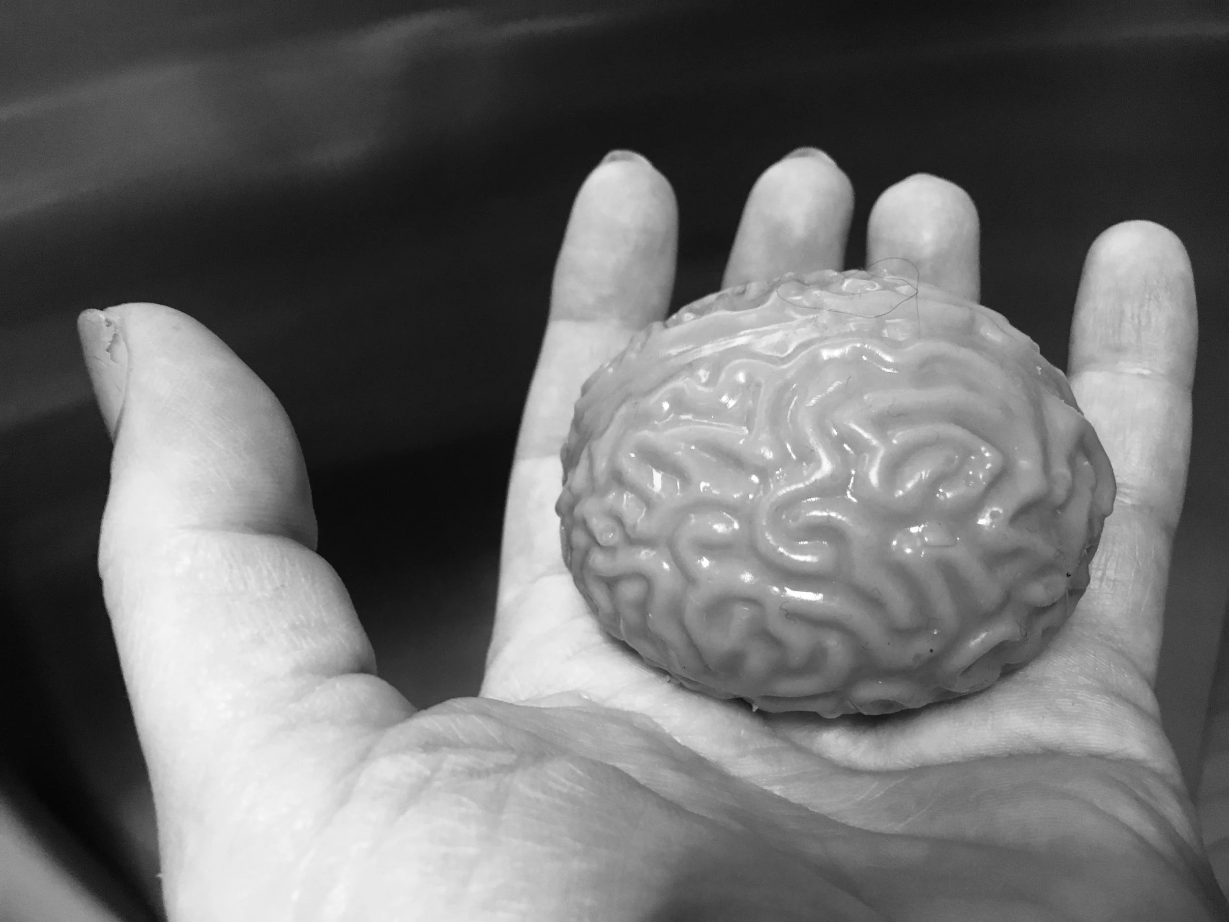 pain as maladaptive neuroplasticity