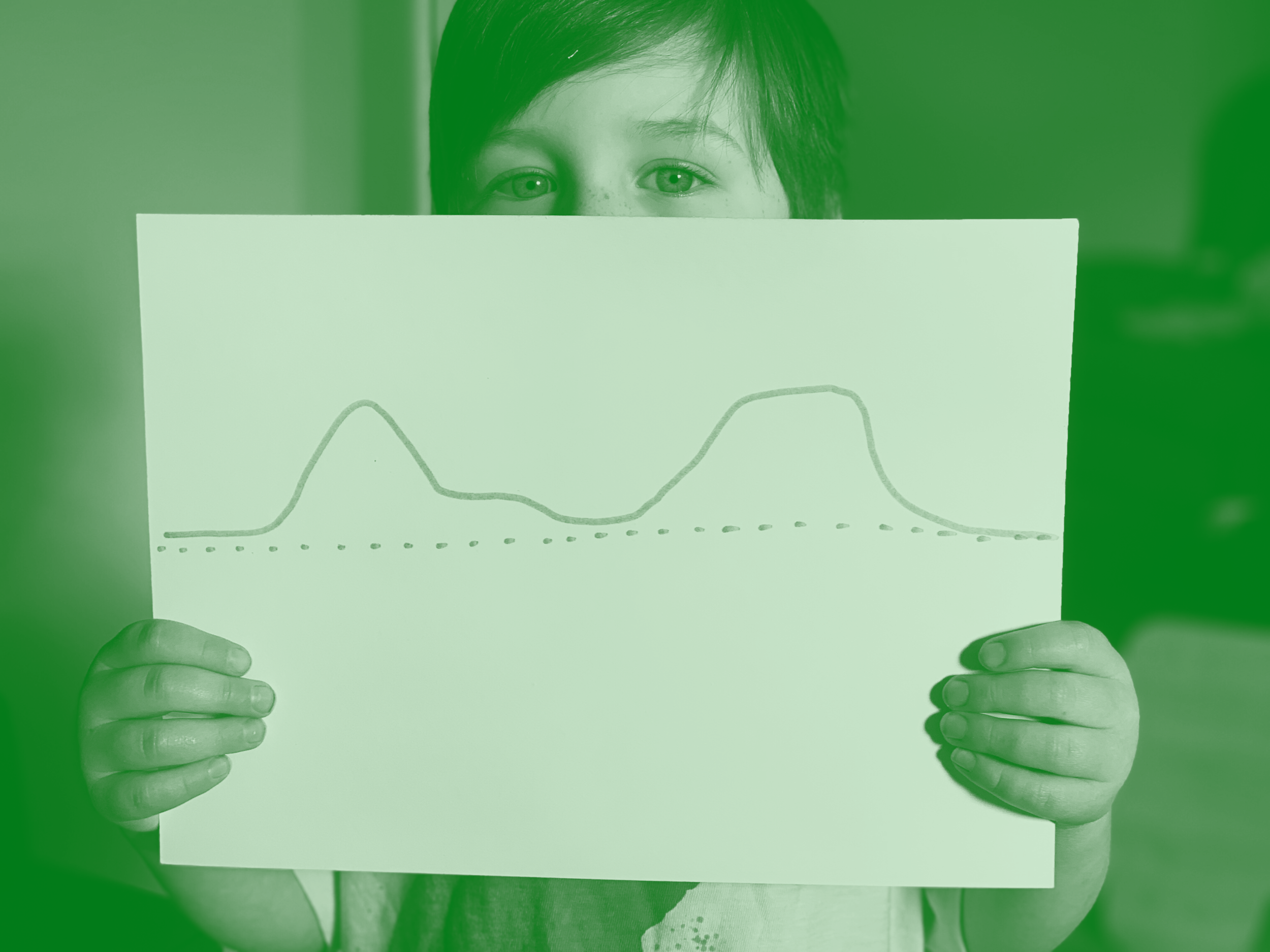 Baseline Versus Flare-Up
