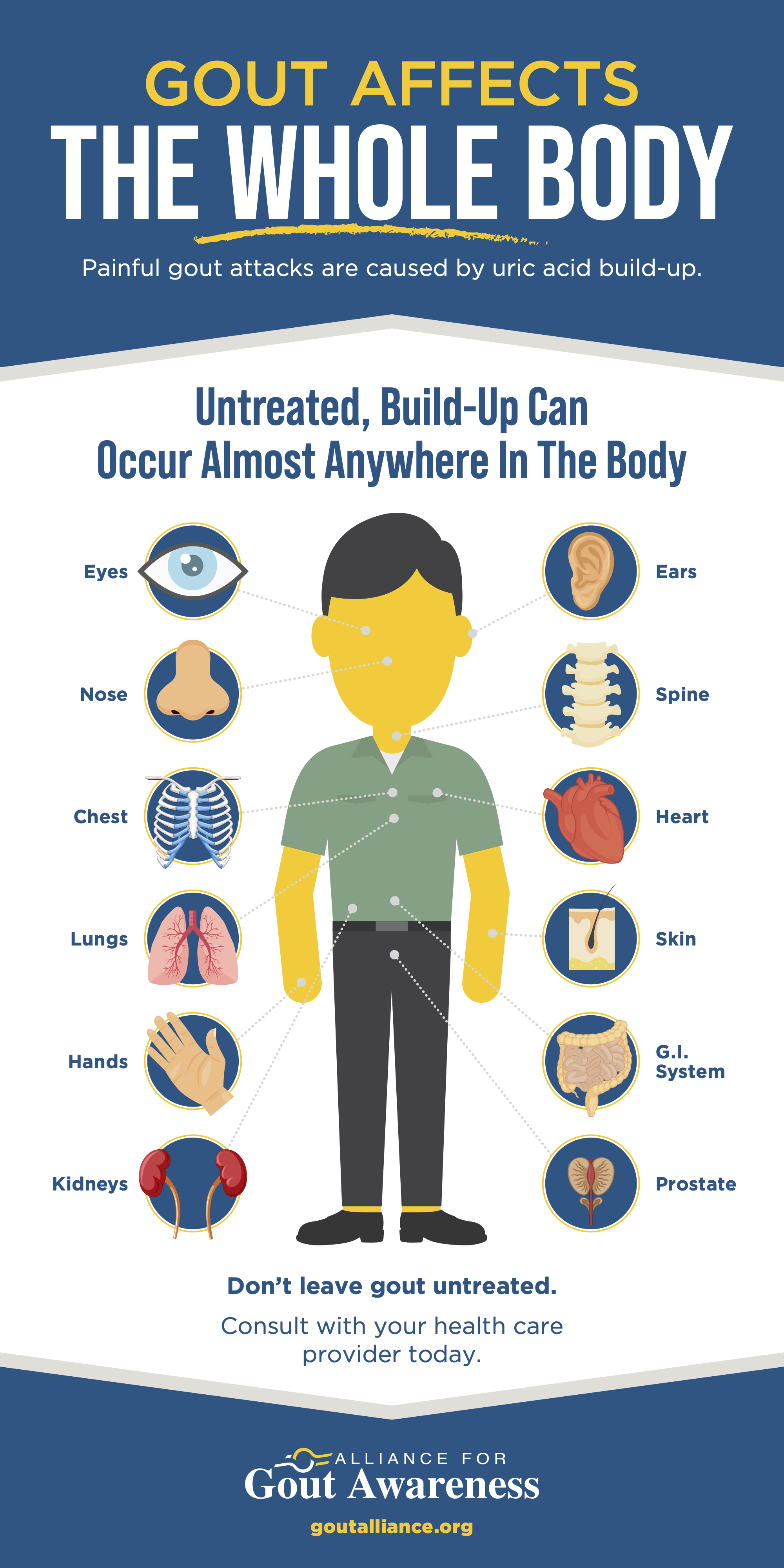 Gout Affects the Whole Body