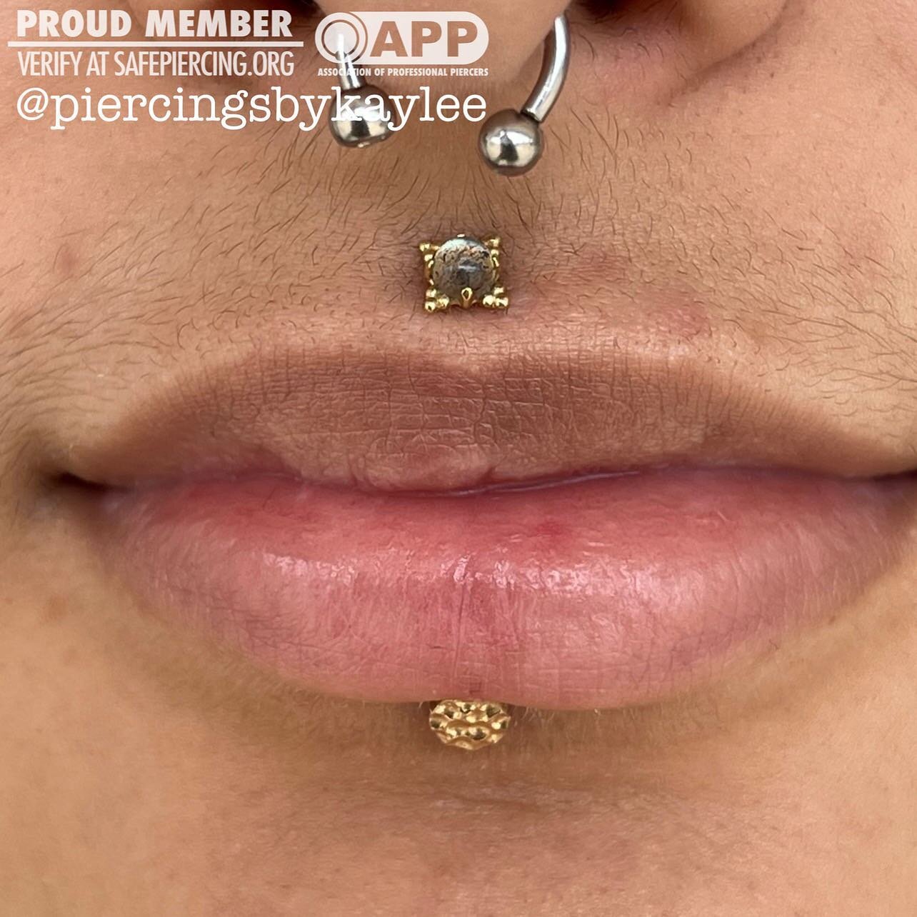 Philtrum and Labret paired lip piercings, three weeks into healing. This photo is of their freshly downsized jewelry. Jewelry in their philtrum is a gorgeous 14k gold Zia end with a labradorite cabochon, Lebret has a 4mm hammered disk end ✨swipe for 