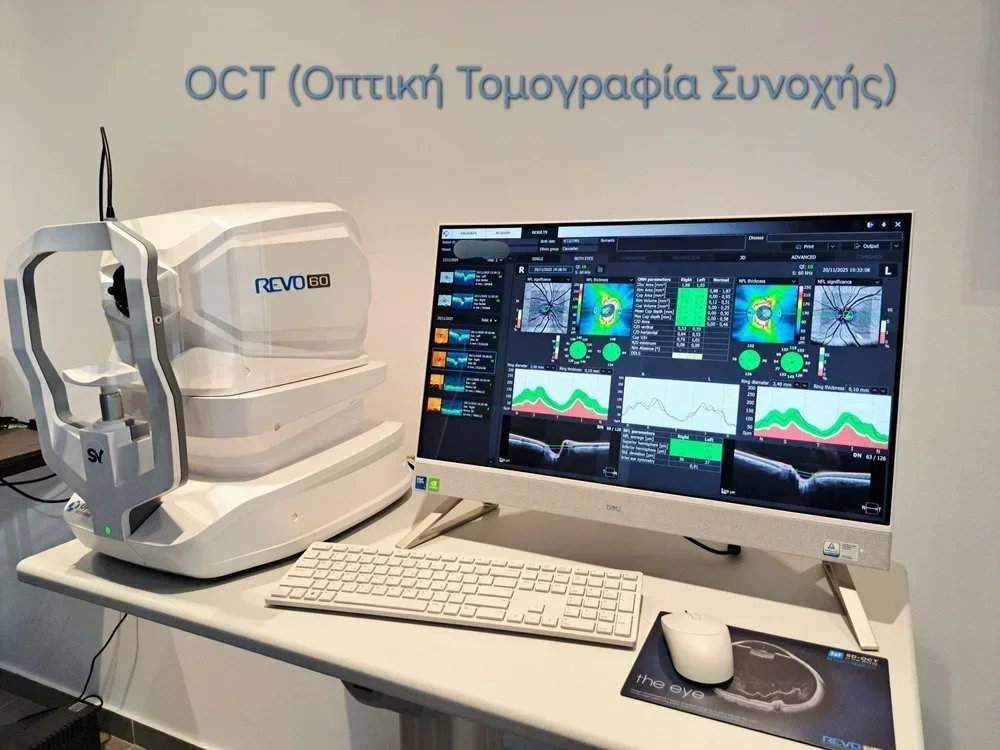 OCT. Προηγμένη απεικονιστική εξέταση στο οφθαλμιατρείο Θεοδώρας Πασχάλογλου