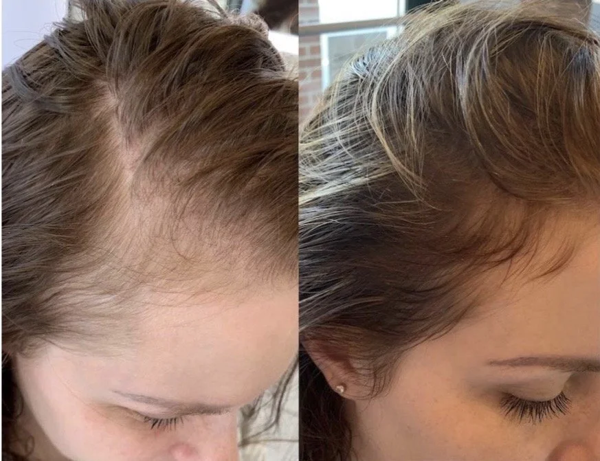 after 10 sessions
