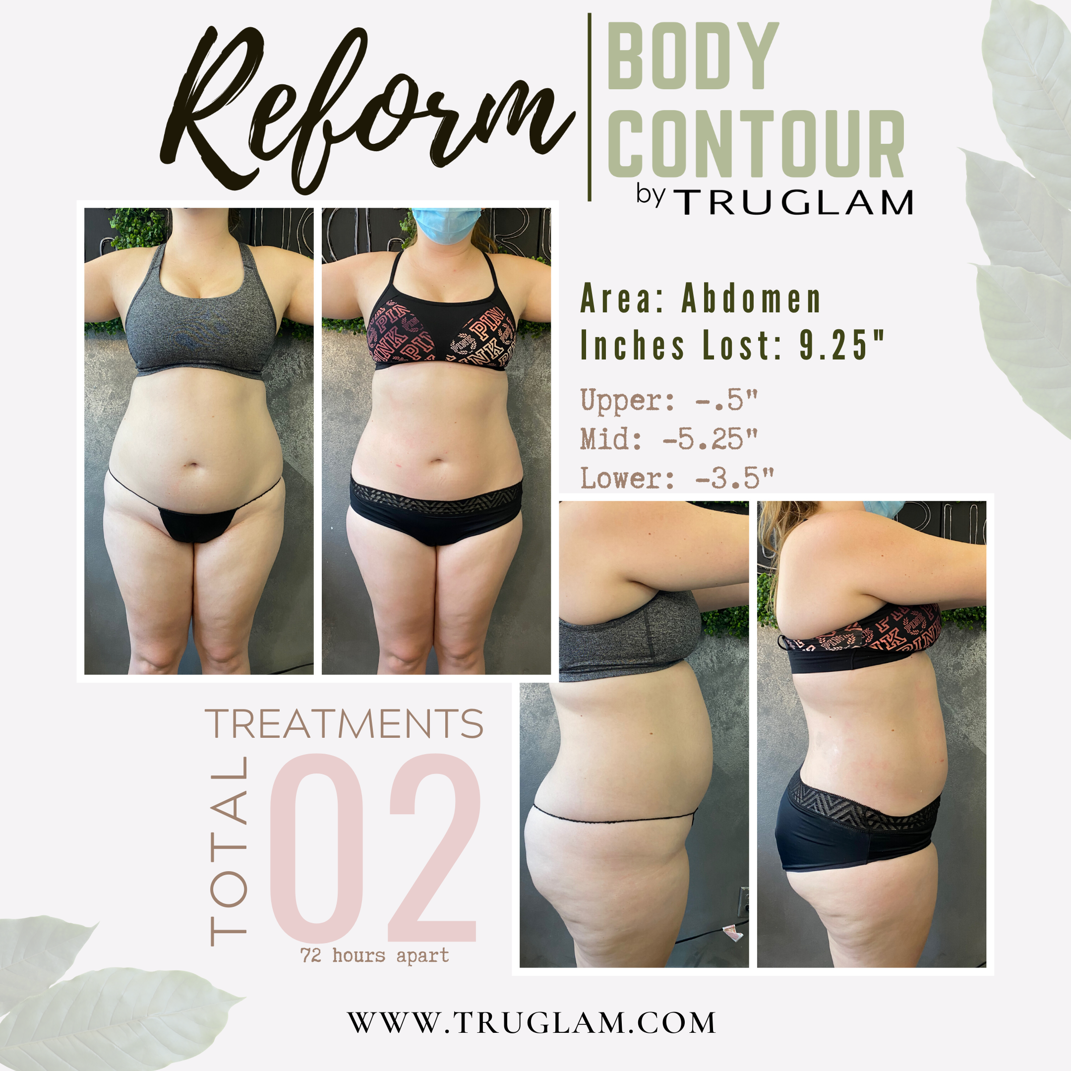 Reform - Body Contouring — TruGlam