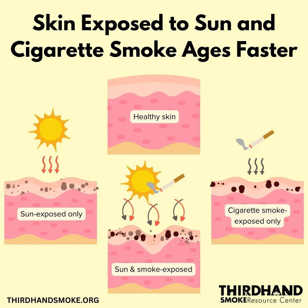 Did you know that the combination of cigarette smoke and sunlight can worsen early skin aging?
Link: https://thirdhandsmoke.org/

Qu&yacute; vị c&oacute; nhận ra sự kết hợp giữa kh&oacute;i thuốc l&aacute; v&agrave; nắng trời c&oacute; thể khiến l&ag