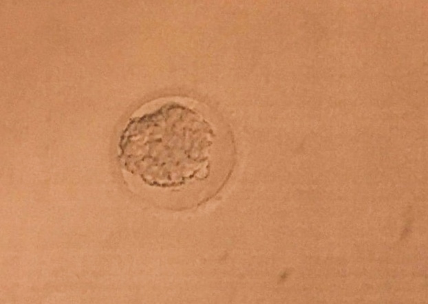 Meet the Embryo!