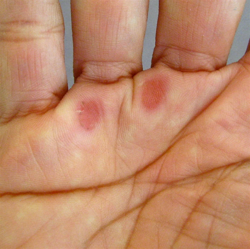 Hand Smiley.jpg