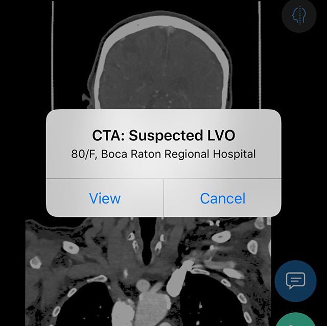 We&rsquo;re the first hospital in Florida to utilize #ai #artificialintelligence to detect stroke, utilizing Viz.ai&rsquo;s revolutionary software. The #cloud based software sends a real-time alert to your #iPhone.  Definitely reduced time to reperfu