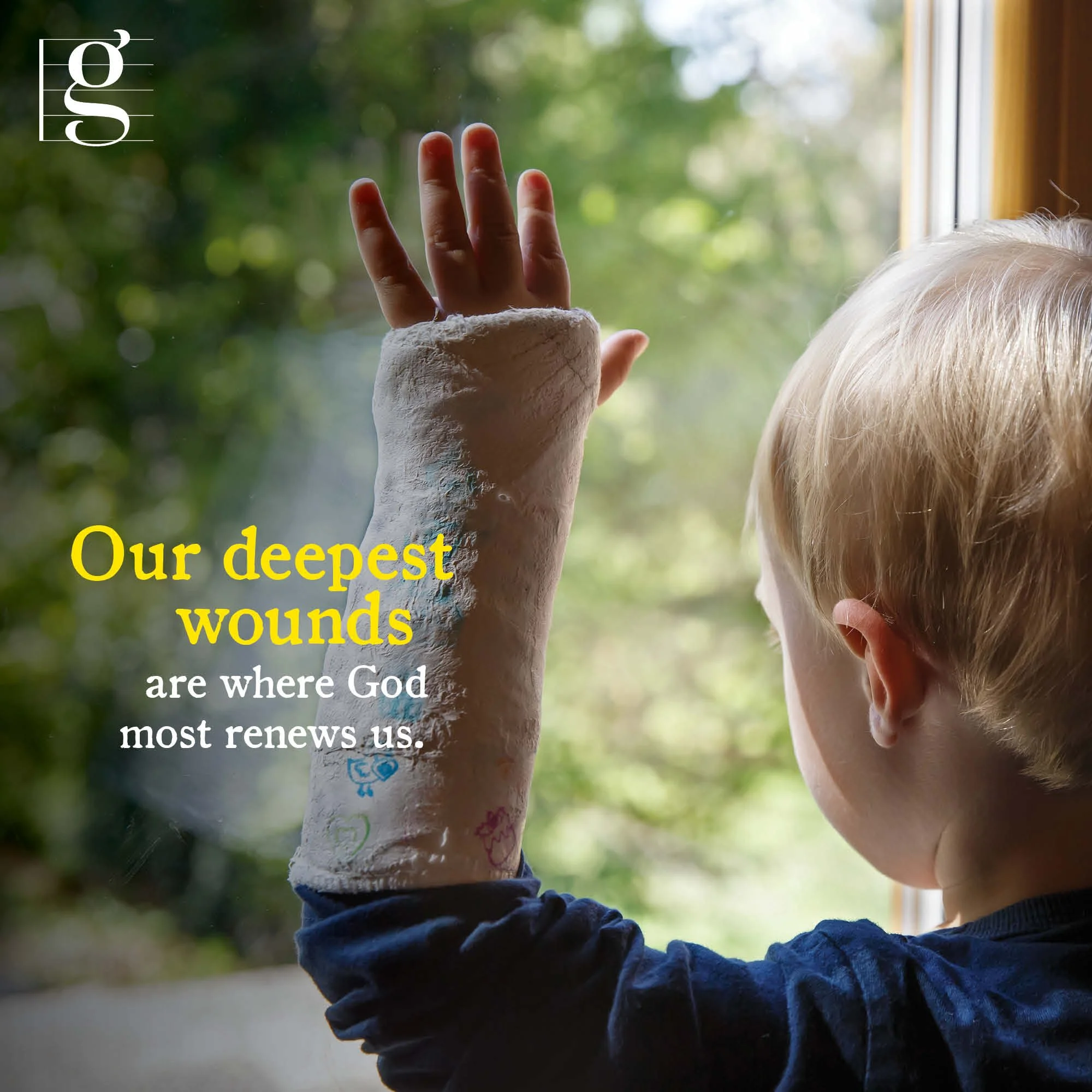 Grace and Scars