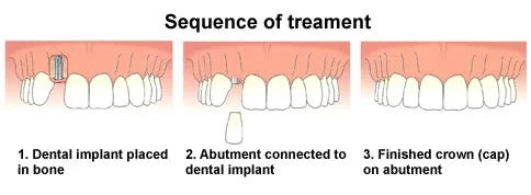 sequence2.jpg