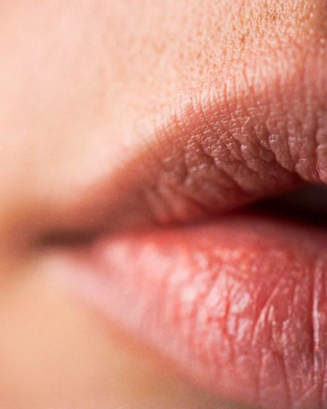 Lips are not meant to look identical.
ㅤ
Some of the most common things we see include asymmetry, variations in lip border definition, changes in hydration, lines and wrinkles and subtle shifts in volume over time.
ㅤ
These differences are completely n