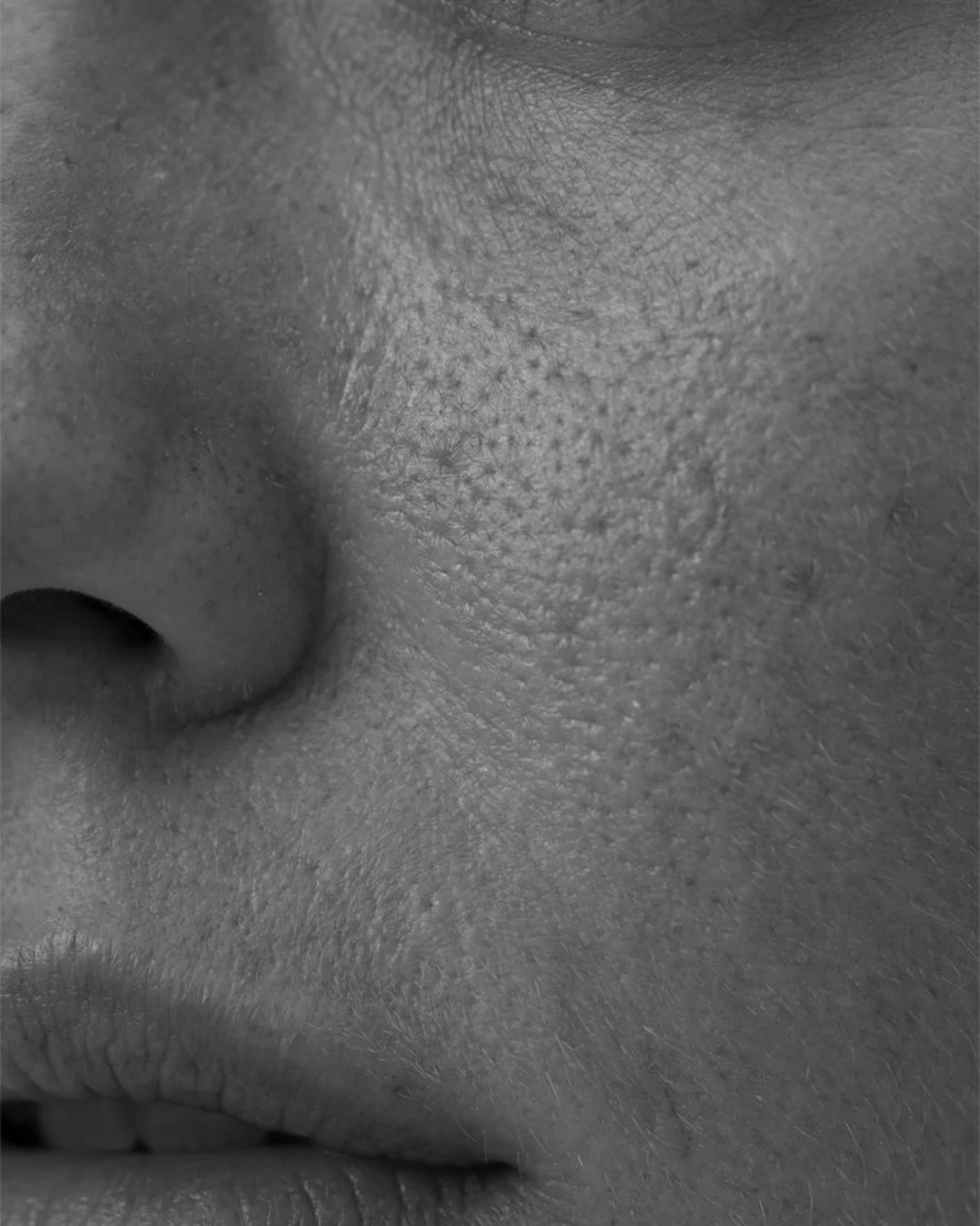 Pores are a normal part of skin anatomy.
ㅤ
Their appearance can be influenced by genetics, oil production, collagen levels, congestion and overall skin condition. Texture can also change over time due to environmental exposure, ageing and skin barrie