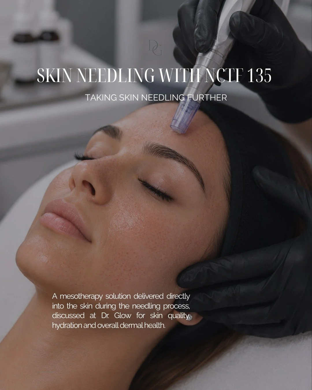 Skin needling at Dr. Glow can be combined with NCTF 135, a polyrevitalising mesotherapy solution containing over 50 active ingredients including vitamins, amino acids, coenzymes, nucleic acids and minerals.
ㅤ
The micro-channels created during the ski