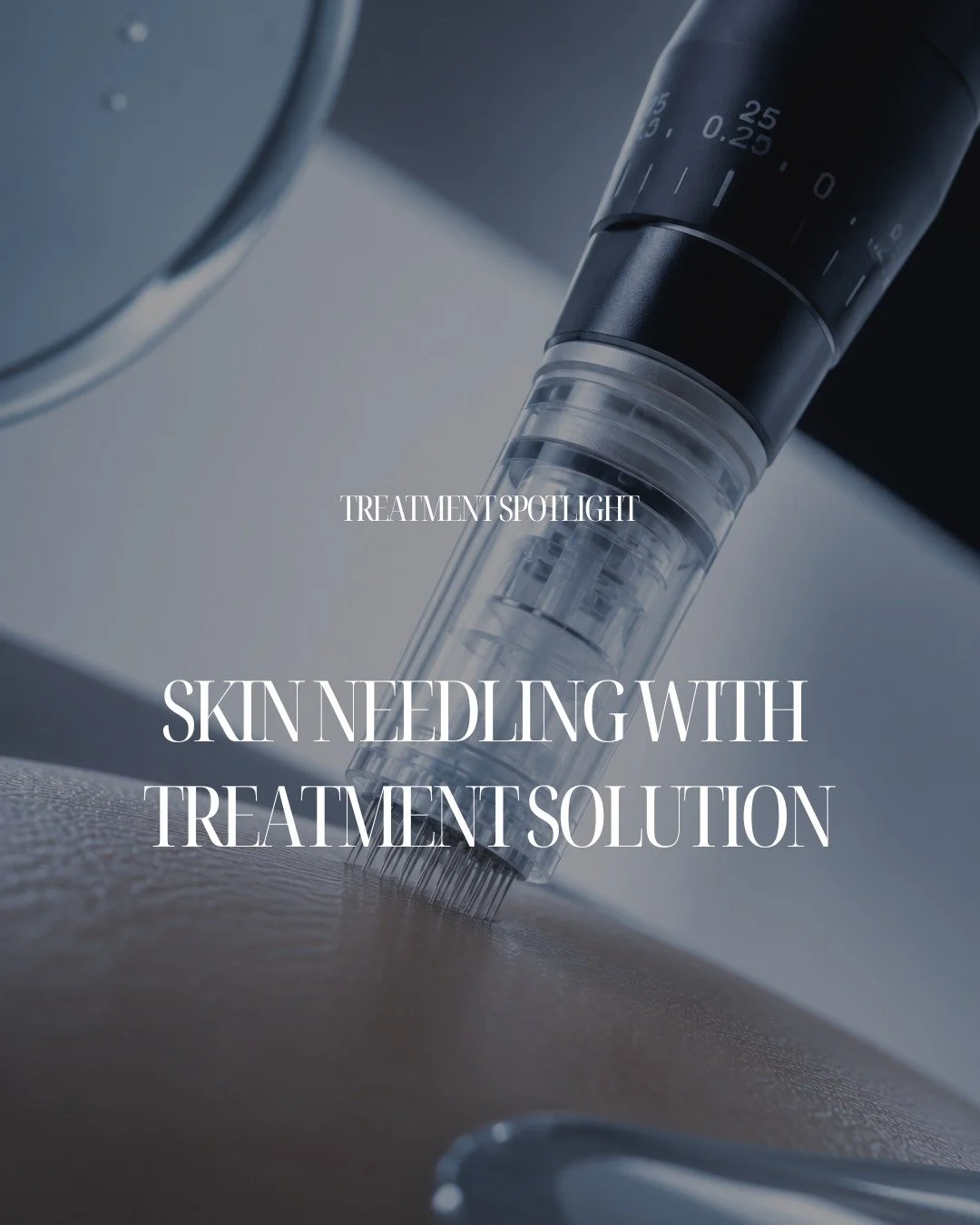 Skin needling at Dr. Glow can be enhanced with the application of a customised treatment solution delivered directly into the skin during the procedure.
ㅤ
The micro-channels created by the needling process allow active ingredients to penetrate signif