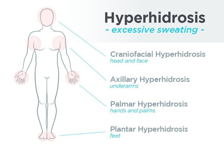 Do you suffer? Come and see us ❤😊 #hyperhidrosis