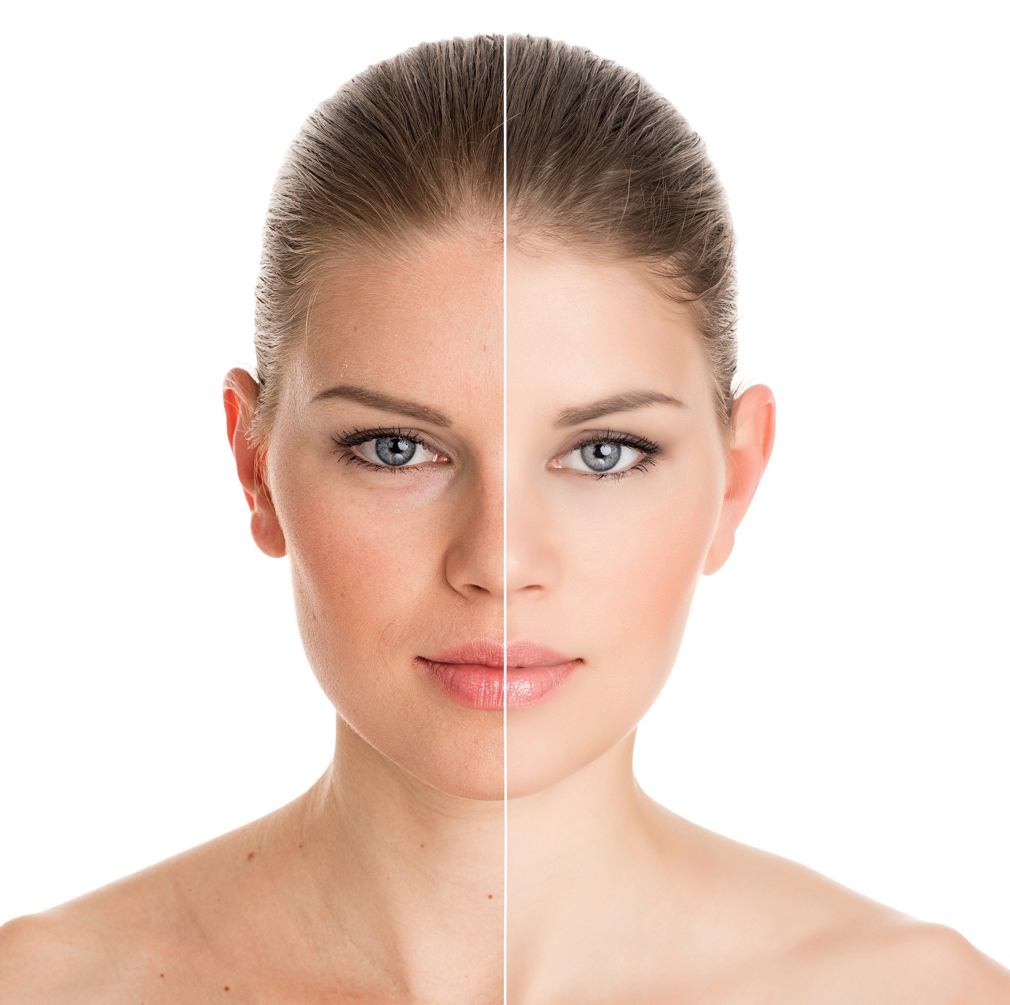Flawless-Future-Med-Spa-Before-After-Page.jpg