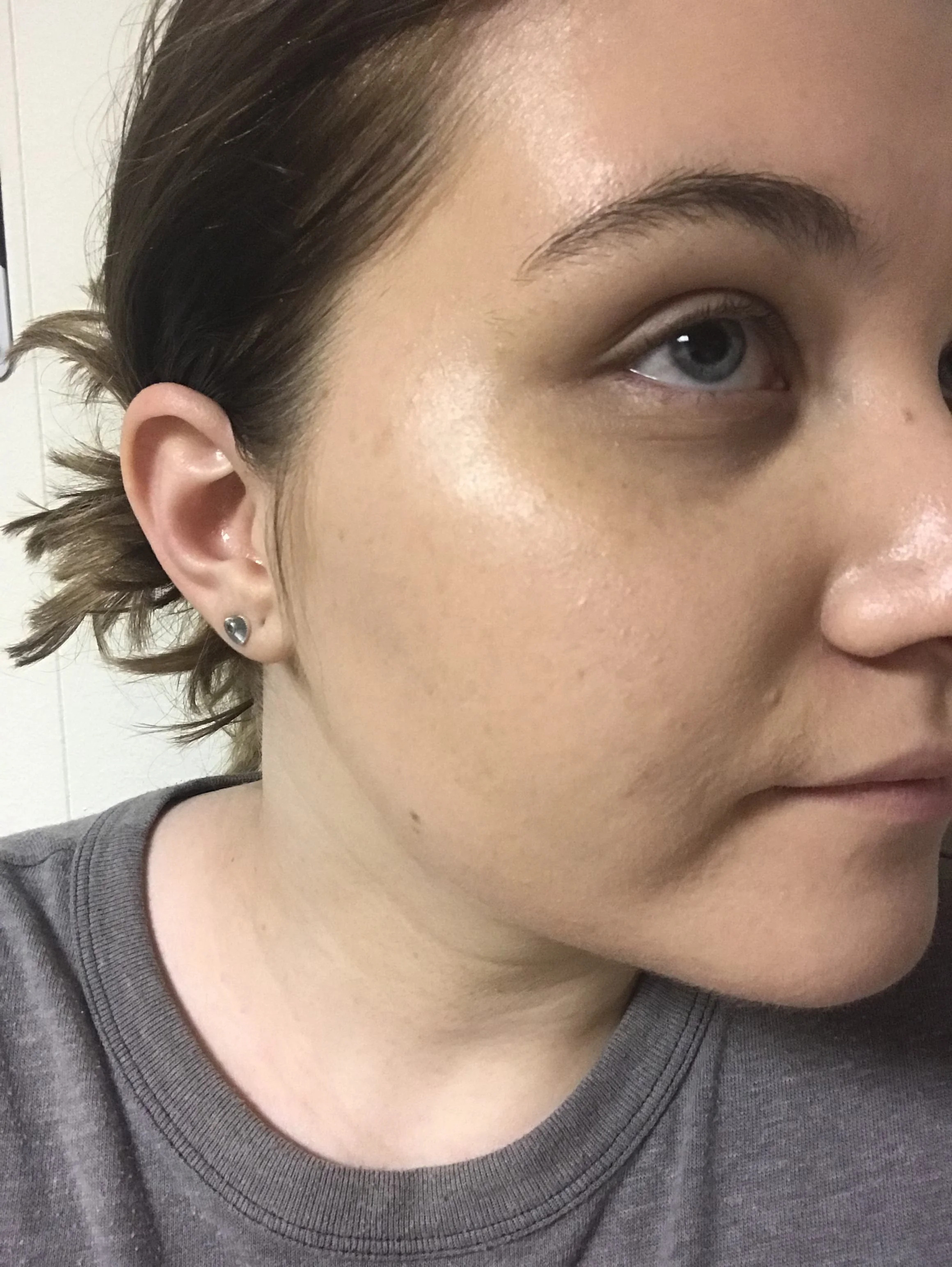 What the foundation looks like applied. Even the lightest shade, still looks too dark for my skin tone and I don’t like the texture.