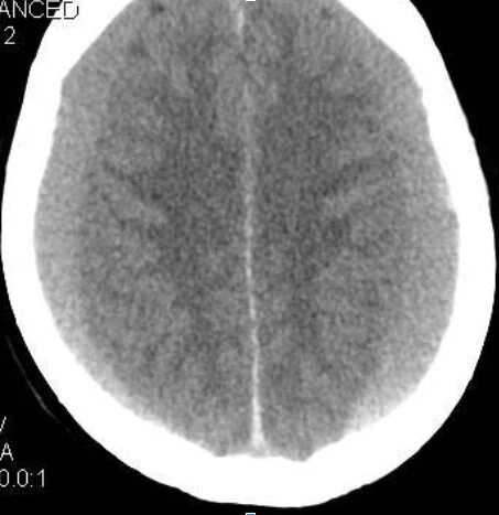neuro3.jpg