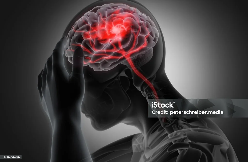 Does Nutrition Promote Neurological Recovery After Acute Brain Injury?