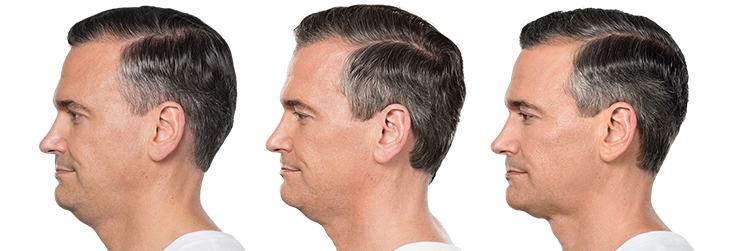 left-image (2).png