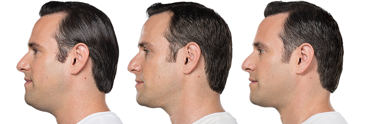 left-image (5).png