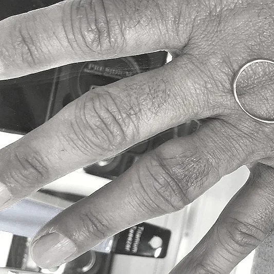 Ring stuck over 30 years, with knuckle enlargement. Removed first try.