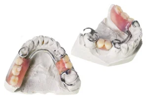 Partial Dentures