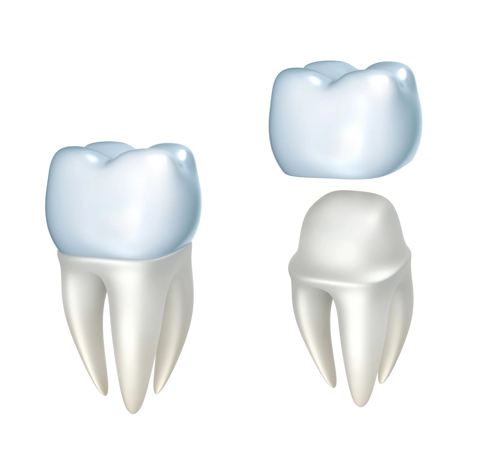 Benefits of Dental Crowns
