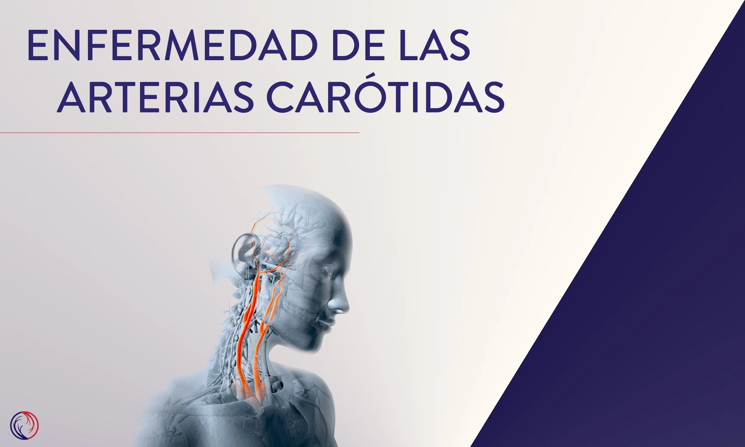 Enfermedad de las arterias carótidas