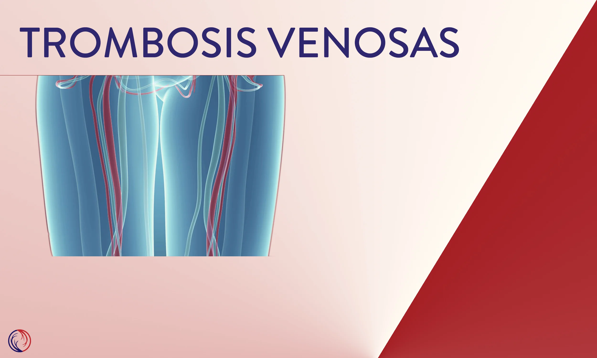 Trombosis venosas