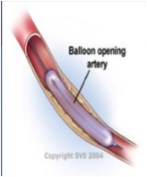 balon.jpg
