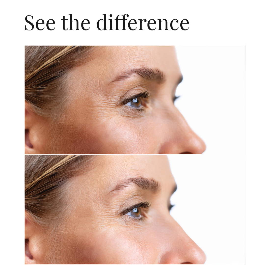 See the Difference.png