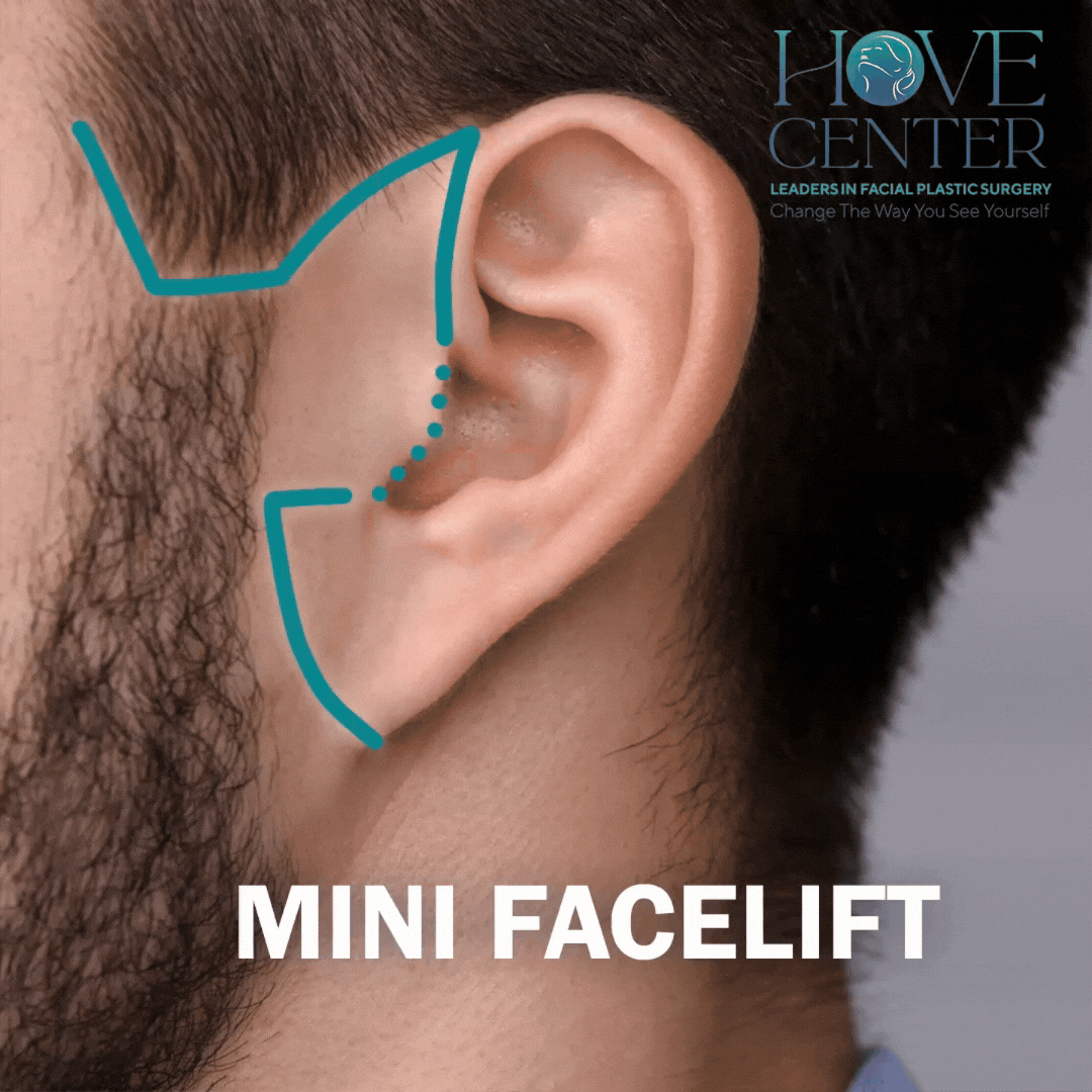 Slice Marketing  copy.gif