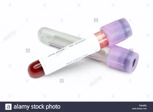 blood-collection-tubes-with-lavender-tops-and-blank-label-on-white-F4X4FD.jpg