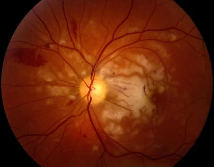 ocular-trauma_420.jpg