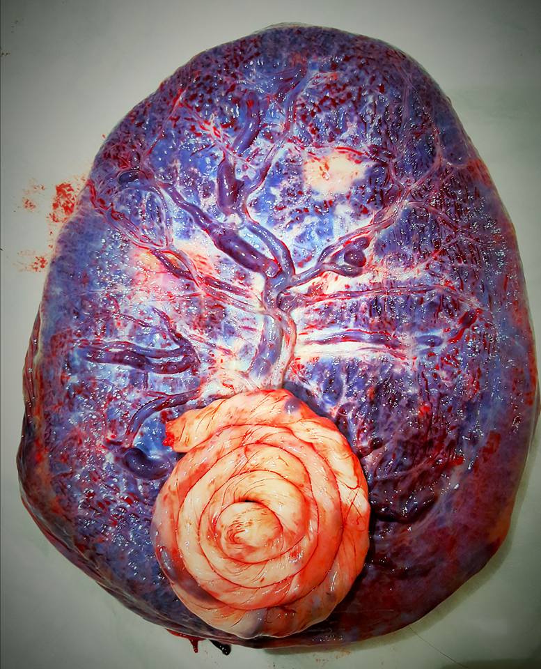 placenta.jpg
