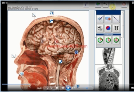 HUNTER-4025-SOFTWARE-18D-lithotherapy-picture-4-5.jpg