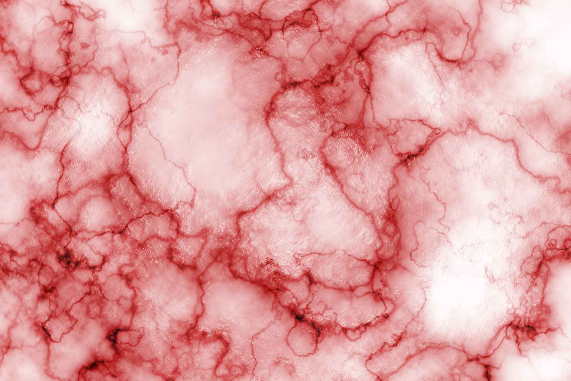 Vascular-lesion-treatment-header-image-web.jpg