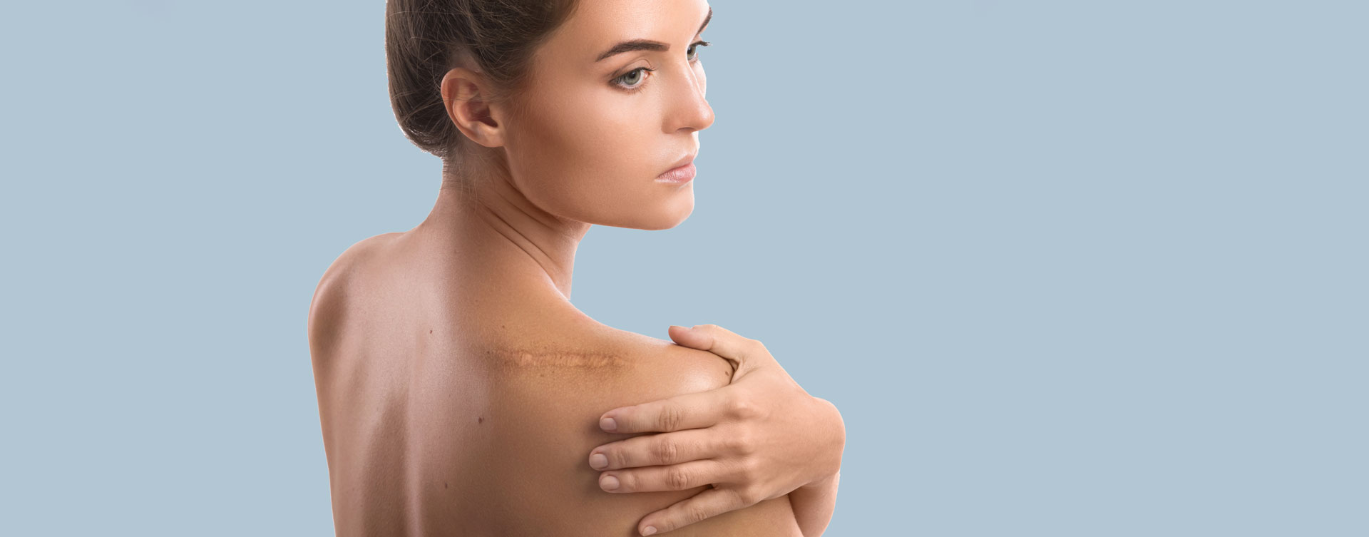 Scar-and-acne-scar-revision-header-image-web.jpeg